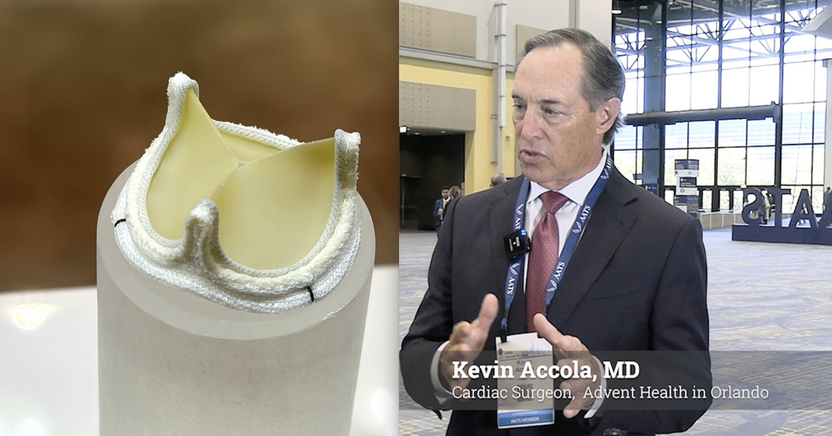 Resilia tissue developed by Edwards Lifesciences associated with long-term durability