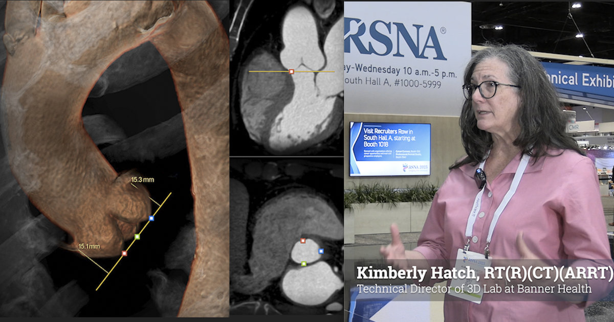 Advanced AI helps 3D imaging labs evolve with the times