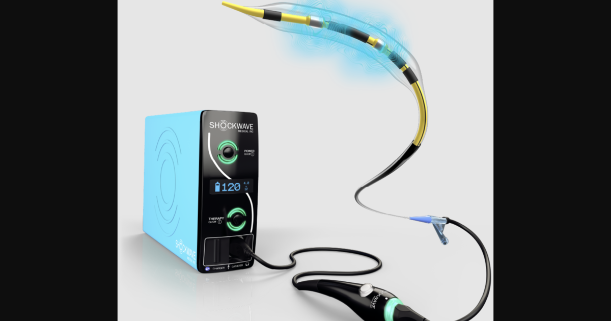 J&J launches Shockwave Medical’s next-generation coronary IVL catheter