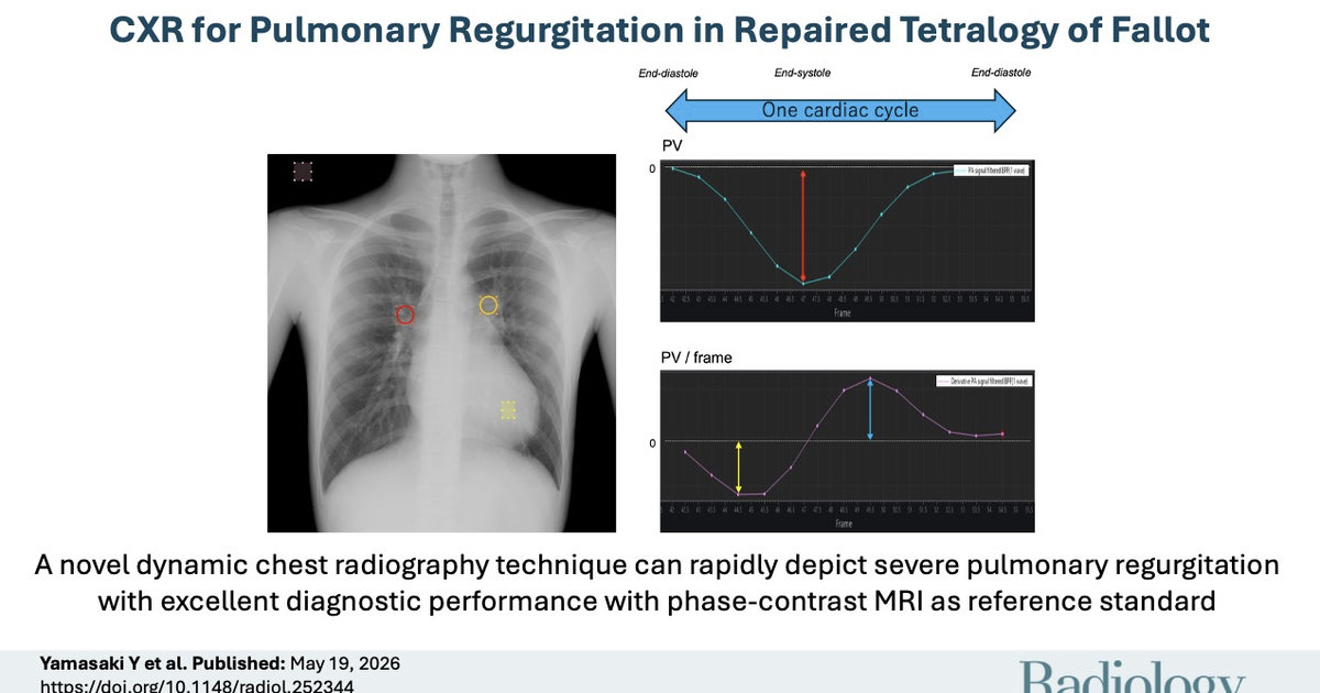 Seven-second X-ray assesses severity of regurgitation congenital heart defect patients