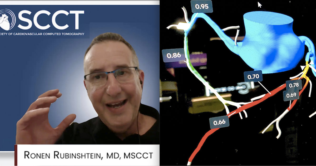 Plaque imaging, AI and structural heart disease in the spotlight at SCCT 2026 meeting