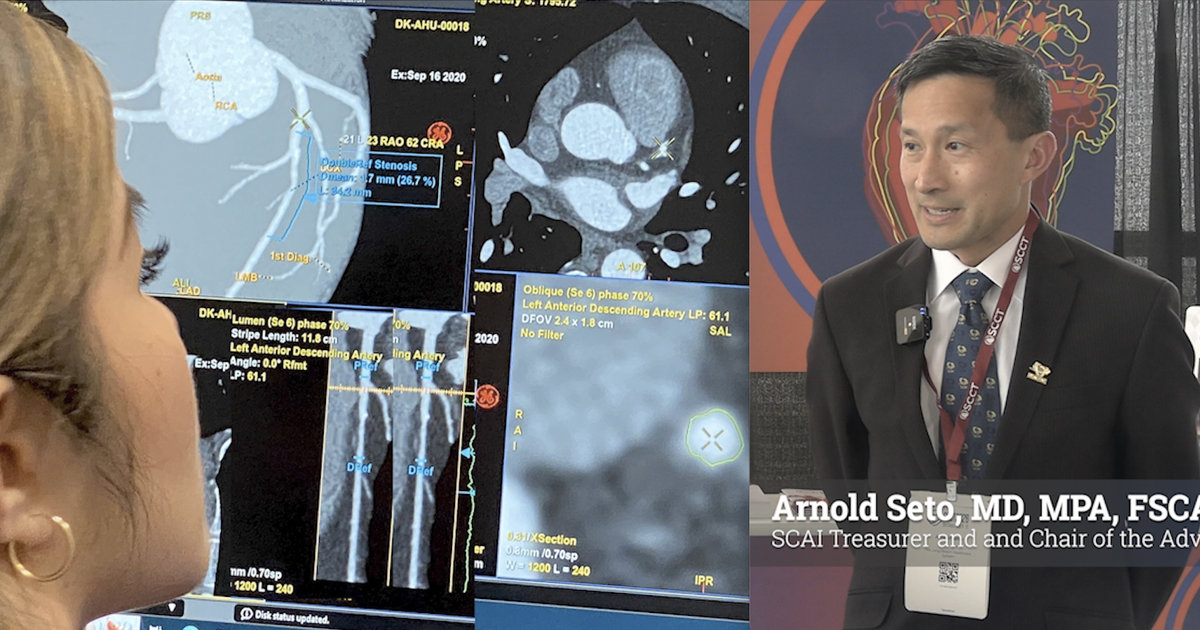 CCTA helping more and more cardiologists plan ahead before PCI