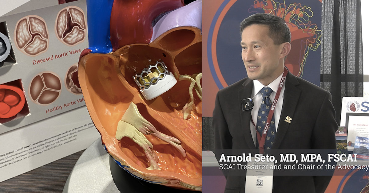 SCAI's position on TAVR changes evolved after member survey
