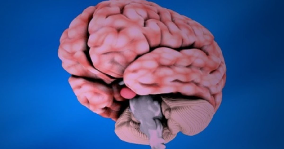 Working before and after stroke associated with better brain health
