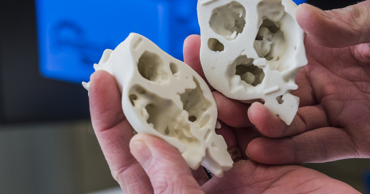 AHA.14: 3D models put hearts in physicians’ hands before surgery