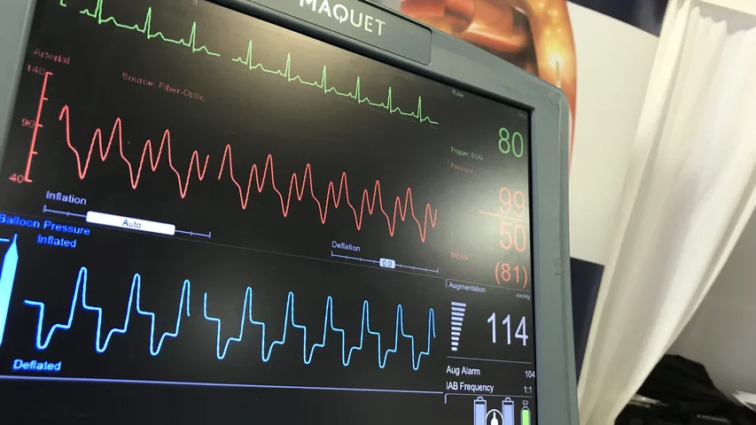 The waveform monitor of a Maquet CardioHelp intra-aortic balloon pump (IABP) on display on the expo floor at ACC 2022. #ACC22