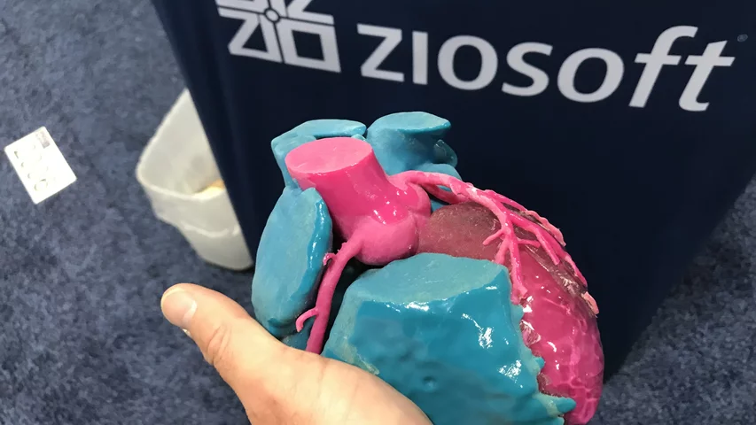 A 3D printed heart for educational and patient procedural planning and guidance on displays by the advanced visualization vendor Ziosoft.