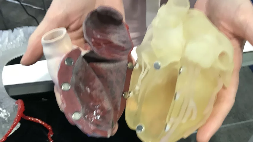 A 3D printed heart used in a congenital heart case to help navigate complex anatomy shown by the 3D printing vendor Axial 3D.