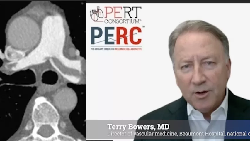 VIDEO Cardiology getting more involved in pulmonary embolism