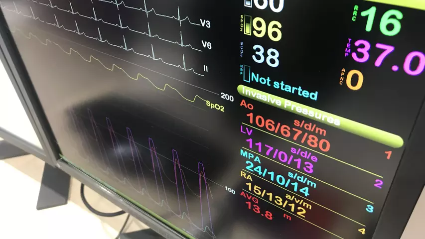 Example of a hemodynamic recording system for use in the cardiac cath lab. This is the Merative hemodynamic system on display at at ACC.23.