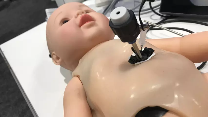 Start-up vendor Pericor displayed a unique direct endoscope visualization port system to guide pericardial needle access at the Innovation Hub at the American College of Cardiology (ACC) 2023 meeting. The vendor said the button like port can be placed in neonates so needle access can be made under direct visualization, since the is little margin for error in the tight space. of a neonate chest. #ACC23 #ACC
