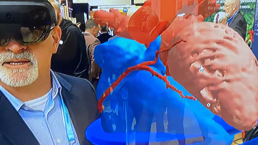 Virtual reality VR augmented reality AR review of a cardiac CT in Microsoft booth HIMSS23.