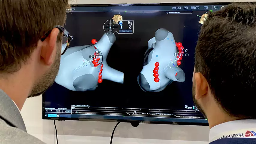 Abbott pulmonary vein isolation PVI for AFib TactiSys Quartz ablation simulator at HRS 2023. Photo by Dave Fornell