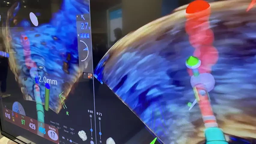 Biosense Webster NuVision Nav 3D 4D ICE integrated with Carto EP mapping system at HRS 2023. Photo by Dave Fornell