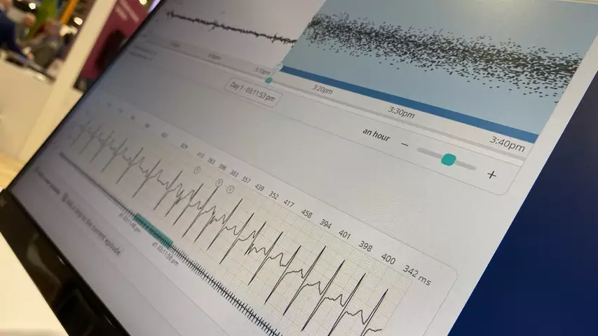 Philips Cardiologs remote monitoring automated ECG analysis demonstration at HRS 2023. Photo by Dave Fornell