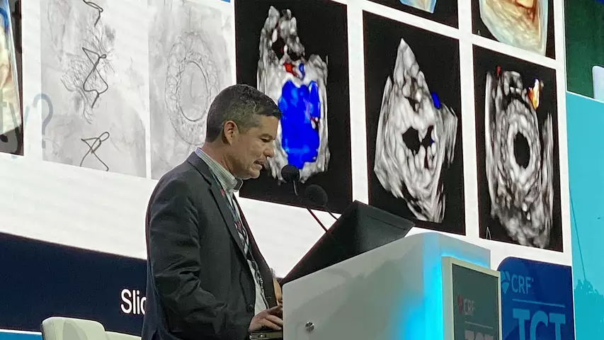 Cephea TMVR trial data explained by Juan Granada at TCT 2023. Photo by Dave Fornell