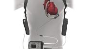 The Abbott HeartMate 3 left ventricular assist system. When Medicare updated its policy on left ventricular assist devices (LVADs) in 2020, making it easier for heart failure patients to receive an LVAD at a health center that does not perform heart transplants, the change was designed to improve patient access and boost outcomes. However, new research published in JAMA Network Open suggests shift may have potentially caused patients to miss out on heart transplants they would have otherwise received.