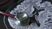 an MRI brain scan and a stethoscope