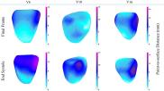 Cardiac MRI