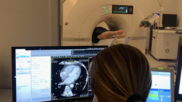 Cardiac CT scan for a pre-procedural assessment of a left atrial appendage occlusion (LAAO) procedure at Duly Healthcare in the Chicago suburbs. Cardiac CT use has increased the past few years and now CMS is looking to double what it pays for them in the 2025 HOPPS proposed rule. Photo by Dave Fornell