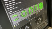 An echo reporting page from the Philips CVIS at ACC 2022. Best in KLAS 2023 rankings for cardiovascular information systems.