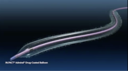 More than 6,000 IN.PACT Admiral Drug-Coated Balloons have been recalled, Medtronic announced Thursday.
