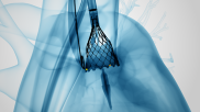 Transcatheter aortic valve replacement (TAVR) patients continue to benefit from an optimized pre- and post-procedural treatment strategy that utilizes the cusp overlap technique and the Evolut Pro and Pro+ TAVR valves, according to new findings presented at EuroPCR 2022 in Paris. 