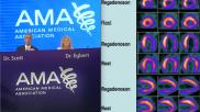 The American Medical Association (AMA) Board of Delegates approved a policy calling on payers to reimburse for the drug regadenoson and not to employ payment policies that push for cardiologists to change the drug they use for pharmacologic stress for one that is considered less safe. The policy was adopted at the AMA 2022 meeting. #AMA #AMA175 #AMAmtg #ASNC