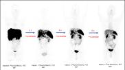 SNMMI abstract of the year, targeted radionuclide therapy