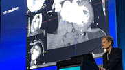 A structural heart Presentation during the TVT 2022 conference. #TCT #TCT22 #TCT2022