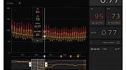 Using fractional flow reserve (FFR) measurements to guide percutaneous coronary intervention (PCI) procedures for patients presenting with multivessel coronary artery disease (CAD) is associated fewer stent implantations, according to a new meta-analysis published in the American Journal of Cardiology. The study’s authors also emphasized that FFR-guided PCI can help improve resource utilization by identifying lesions that do not require treatment.