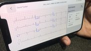 Remote ECG access on a smart phone via the Viz.ai Cardio Suite, which enables access to dynamic ECG, echo, MRI, CT images and reports. It also enables automated detection on imaging to alert care teams for STEMI, hypertrophic cardiomyopathy, pulmonary embolism, aortic dissection and abdominal aortic aneurysm, and heart failure.