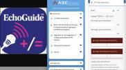 The American Society of Echocardiography (ASE) launched its new, interactive EchoGuide mobile and web application for healthcare professionals last week, and the society said it already has about 15,000 downloads.