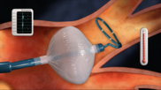 Medtronic’s Arctic Front cryoballoon catheters