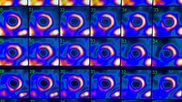Cardiac SPECT perfusion exam using Mo-99 based technetium 99m, which makes up the vast majority of cardiac perfusion imaging exams. Photo by Dave Fornell