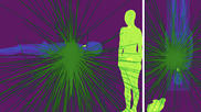 X-ray photon trajectory during the simulation phantom study from the side and top views. Due to scattering of the X-rays when they hit the lower end of the patient bed, exposure in mainly to the lower body of the interventional echocardiographer performing transesophageal echocardiography. The green lines are the scattered photon trajectories calculated by Monte Carlo simulation in the study.