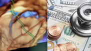 The Society for Cardiovascular Angiography and Interventions (SCAI), American College of Cardiology (ACC) and Heart Rhythm Society (HRS) have asked the U.S. Centers for Medicare and Medicaid Services (CMS) to clarify a key detail related to the national coverage determination (NCD) for percutaneous left atrial appendage closure (LAAC).