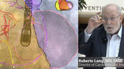 Roberto Lang, MD, explained the AI advances in echocardiography that will make it a requirement to have in the coming years at ASE 2023. #ASE #AIhealthcare #ASE2023