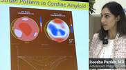 Roosha Parikh, MD, advanced imaging cardiologist, St. Francis Heart Hospital, Long Island, New York, and a clinical assistant professor of medicine at the State University of New York at Stony Brook, presented in one of the ASE 2023 amyloid sessions and spoke with Cardiovascular Business about the disease. Example of cardiac ultrasound strain imaging for cardiac amyloidosis. 