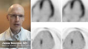 Jamie Bourque, MD, discusses fluorodeoxyglucose (FDG) and its growing use cases in cardiac PET imaging He discussed the radiotracer in sessions at ASNC 2023. #ASNC #ASNC23 #ASNC2023