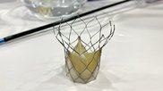Navitor TAVR valve in the Abbott booth at TCT 2023. Photo by Dave Fornell