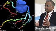 Himanshu Gupta, MD, explains use of FFR-CT in daily practice at Valley Health System, New Jersey at SCCT 2023. #FFRCT #Heartflow #SCCT #SCCT23 #SCCT2023
