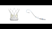 Abbott's Navitor TAVR valve