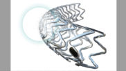 Biotronik has received the FDA’s breakthrough device designation for its Freesolve below-the-knee resorbable magnesium scaffold (BTK RMS) for patients with chronic limb-threatening ischemia (CLTI).