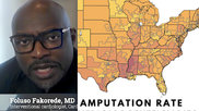 Foluso Fakorede, MD, interventional cardiologist, Cardiovascular Solutions of Central Mississippi, explains how he moved to rural Mississippi, the epicenter of the PAD and CLI epidemic, to open a practice to take action and reverse the glaring health disparities and that are leading to more than 400 leg amputations per day in the U.S.