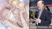 Heart Rhythm Socity (HRS) President Kenneth Ellenbogen, MD, explains key electrophysiology (EP) trends at the HRS 2024 meeting. #HRS #HRS24 #HRS2024 #EPeeps