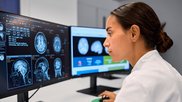 icometrix MRI brain alzheimer's