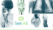 See All AI