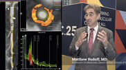 Matthew Budoff explains use of CCTA to track coronary disease plaque progression