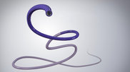 Toro Neurovascular Toro 88 Superbore Catheter 